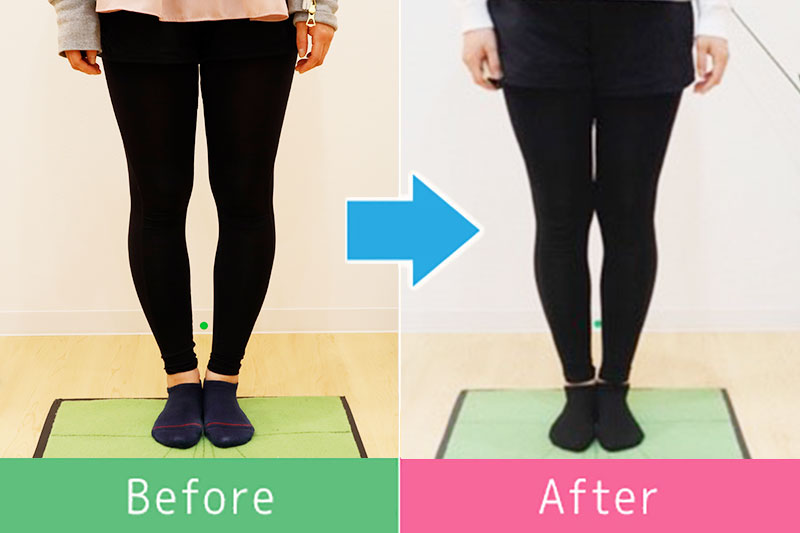 美脚 ビフォーアフター1
