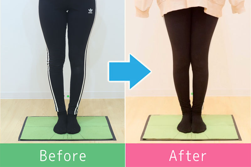 美脚 ビフォーアフター3
