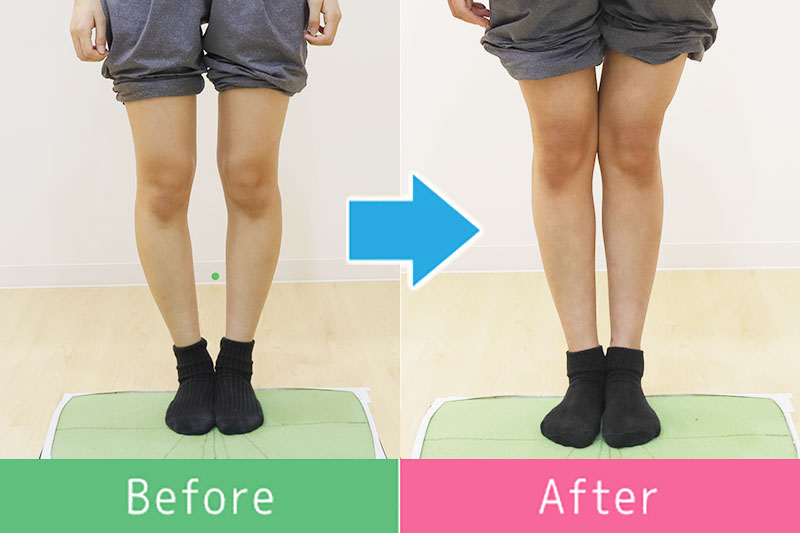 美脚 ビフォーアフター4