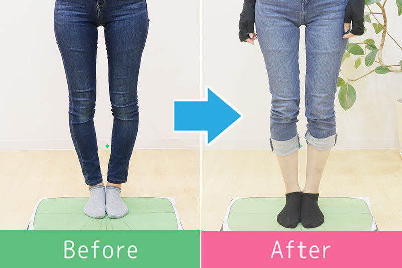 美脚 ビフォーアフター5