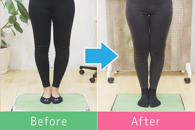 美脚 ビフォーアフター7