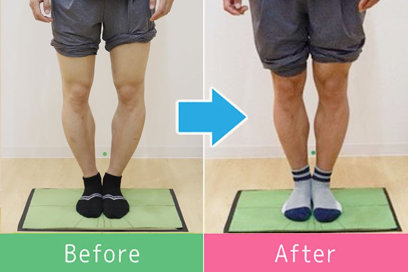 美脚 ビフォーアフター8