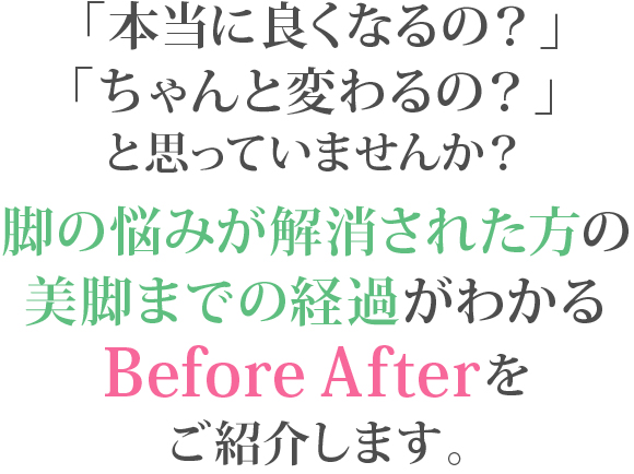 「本当に良くなるの?」「ちゃんと変わるの?」と思っていませんか?脚の悩みが解消された方の美脚までの経過がわかるBefore Afterをご紹介します。